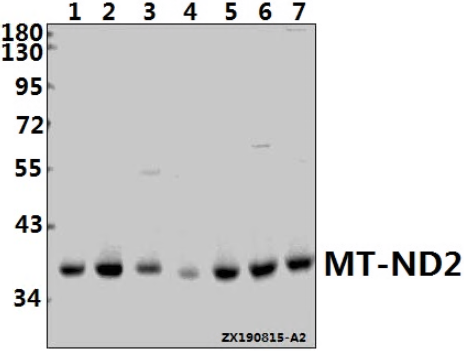 a04475 mt nd2 primary antiboties wb testing 1