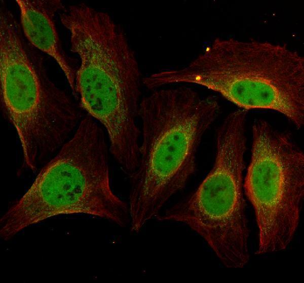 IF analysis of C11orf30/EMSY using anti-C11orf30/EMSY antibody (A04477-1) and anti-Alpha Tubulin antibody (M03989-3)