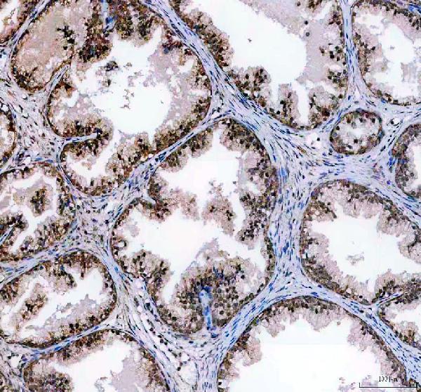 IHC analysis of C11orf30/EMSY using anti-C11orf30/EMSY antibody (A04477-1)