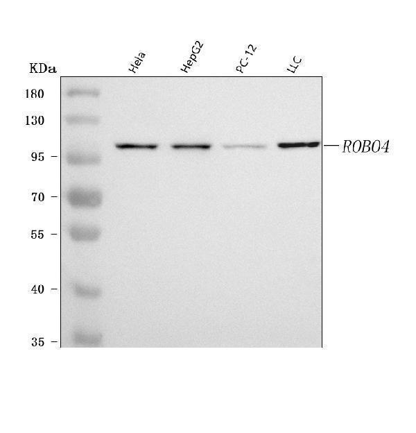  Western blot analysis of ROBO4 using anti-ROBO4 antibody (A04479-2)