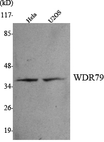 Western Blot analysis using WDR79 Monoclonal Antibody against HeLa, U2OS cell lysate