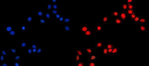  IF analysis of KIF4A/4B using anti-KIF4A/4B antibody (A04486-1)