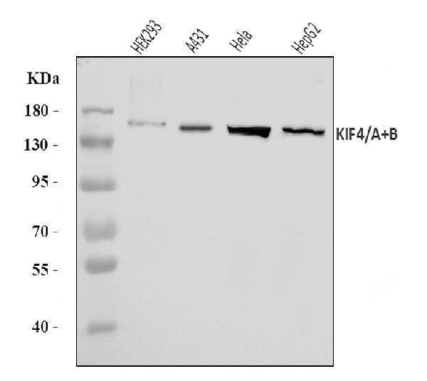  Western blot analysis of KIF4A/4B using anti-KIF4A/4B antibody (A04486-1)