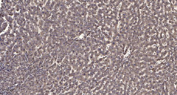 a04486 kif4a primary antibodies ihc testing 1