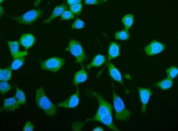 a04488 2 larp1 primary antibodies if testing 4