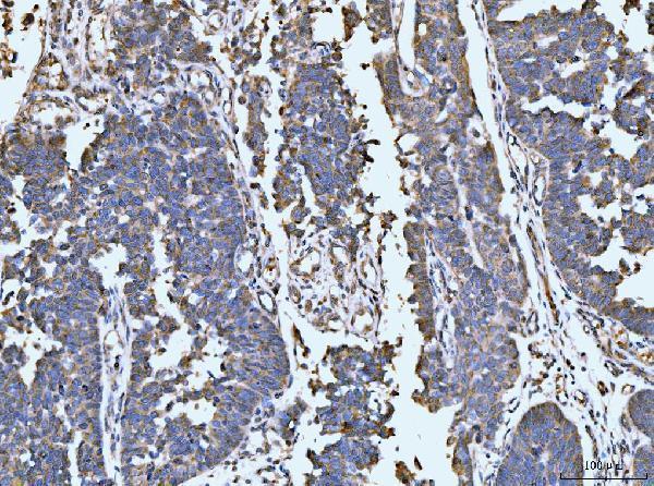  IHC analysis of LARP1 using anti-LARP1 antibody (A04488-2)