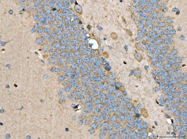  IHC analysis of LARP1 using anti-LARP1 antibody (A04488-2)