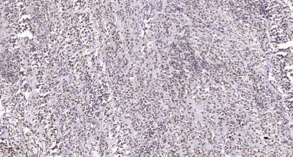 a04489 1 srsf6 primary antibodies ihc testing 1