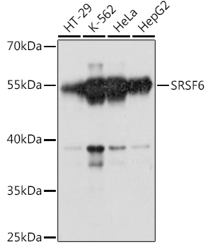 a04489 srsf6 primary antiboties wb testing 1