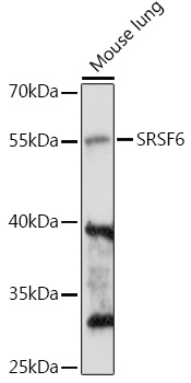 a04489 srsf6 primary antiboties wb testing 2