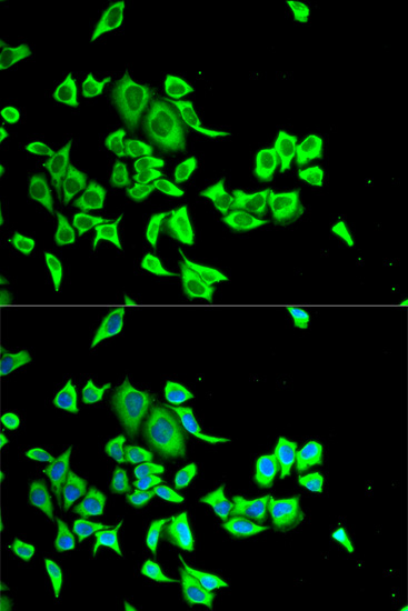 Immunofluorescence analysis of Hela cells, using SERPINB1 polyclonal antibody