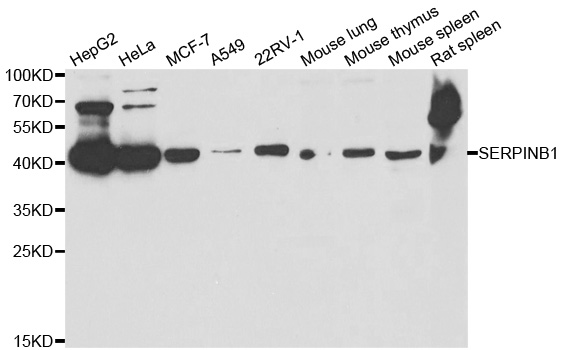 WesternBlot (WB) analysis of SERPINB1 polyclonal antibody