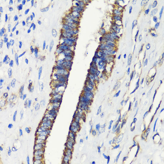 a04492 2 fkbp1a primary antiboties ihc testing 3