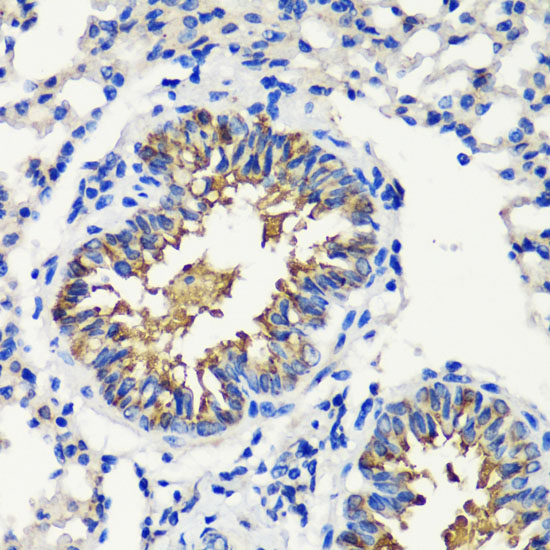 a04492 2 fkbp1a primary antiboties ihc testing 4