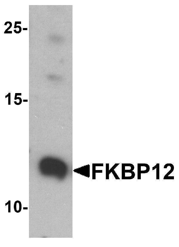 a04492 fkbp1a primary antibodies wb testing 1
