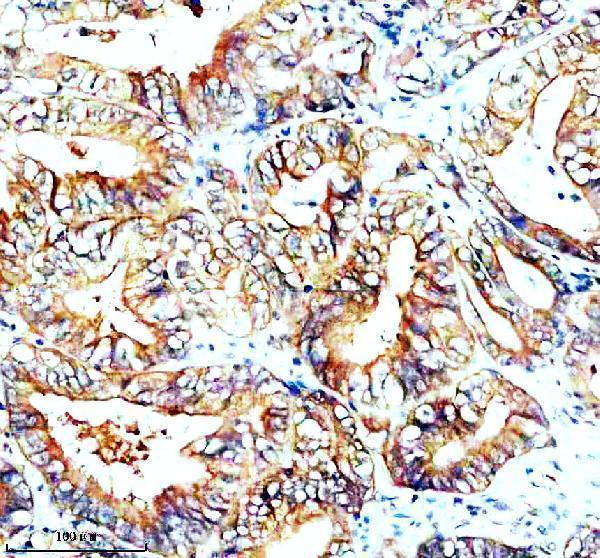 IHC analysis of SNX2 using anti-SNX2 antibody (A04493-1)