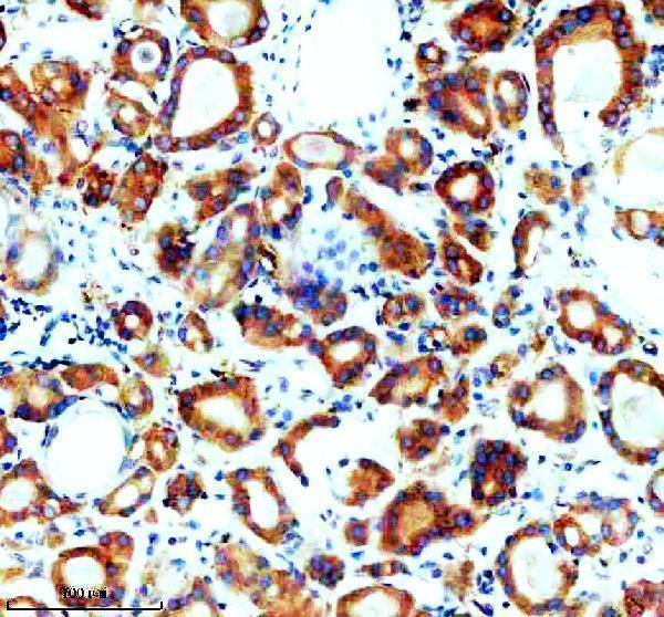IHC analysis of SNX2 using anti-SNX2 antibody (A04493-1)