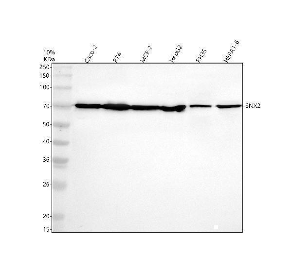 Western blot analysis of SNX2 using anti-SNX2 antibody (A04493-1)