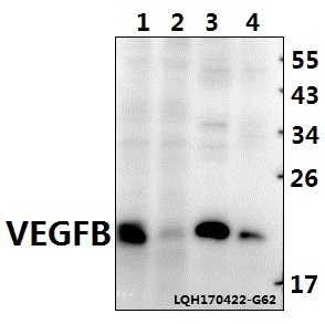 Western blot (WB) analysis of VEGFB (R125) polyclonal antibody at 1:500 dilution
Lane1:K562 whole cell lysate(40ug)
Lane2:A549 whole cell lysate(40ug)
Lane3:The Heart tissue lysate of Rat(40ug)
Lane4:The Heart tissue lysate of Mouse(40ug)