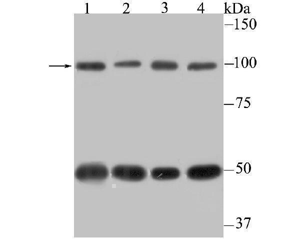 a04496 2 cse1l primary antiboties wb testing 1