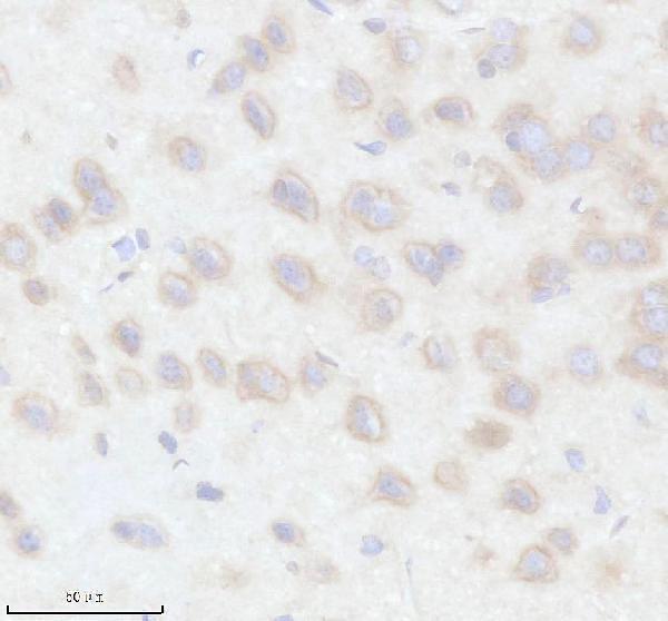 IHC analysis of RPL22 using anti-RPL22 antibody (A04499-2)