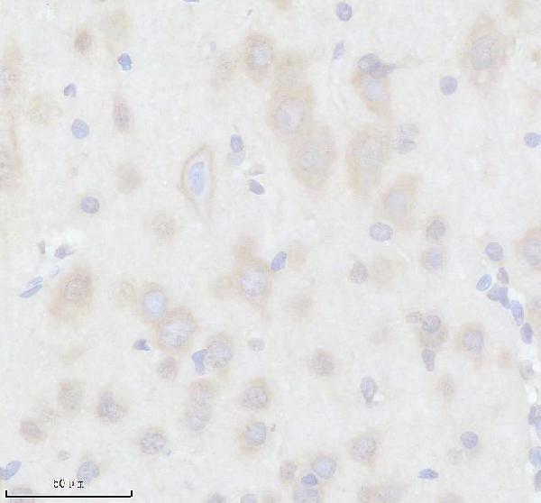IHC analysis of RPL22 using anti-RPL22 antibody (A04499-2)