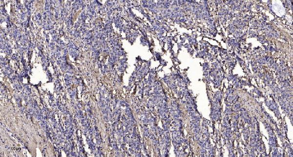 a04501 wipf1 primary antibodies ihc testing 1