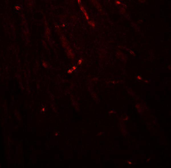 Immunofluorescence of KCNK1 in mouse brain tissue with KCNK1 antibody at 20 μg/ml