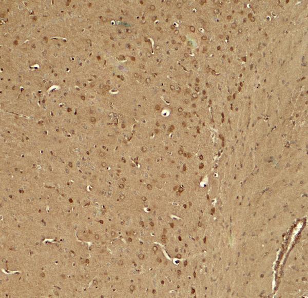Immunohistochemistry of KCNK1 in mouse brain tissue with KCNK1 antibody at 5 μg/ml
