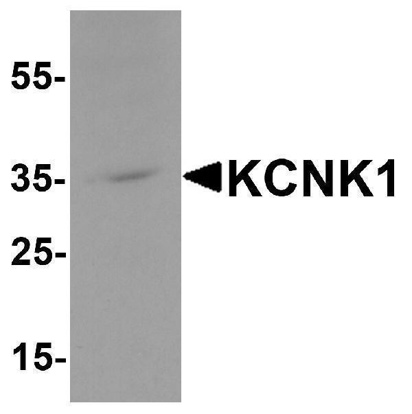 Western blot analysis of KCNK1 in 3T3 cell lysate with KCNK1 antibody at 1 μg/ml