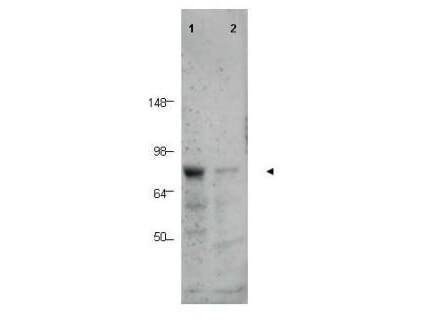 Western blot using Boster's Affinity Purified anti-BORIS antibody shows detection of a predominant band corresponding to BORIS in human tissue lysates (arrowhead)