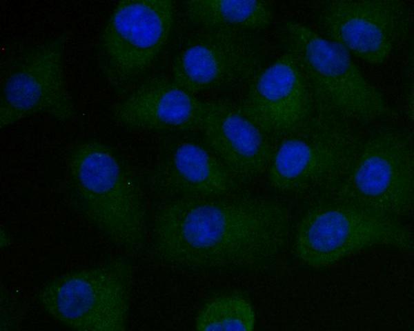 a04504 1 psenen primary antiboties icc testing 2