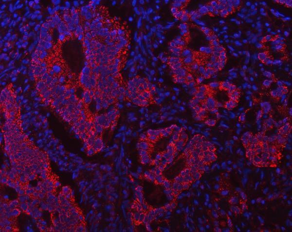 a04508 1 echs1 primary antibodies if testing 11