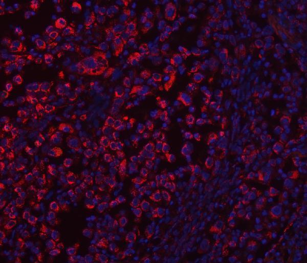 a04508 1 echs1 primary antibodies if testing 12