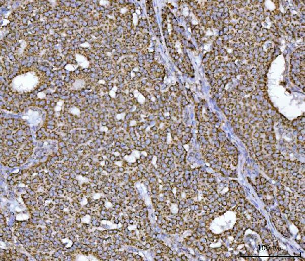 a04508 1 echs1 primary antibodies ihc testing 3