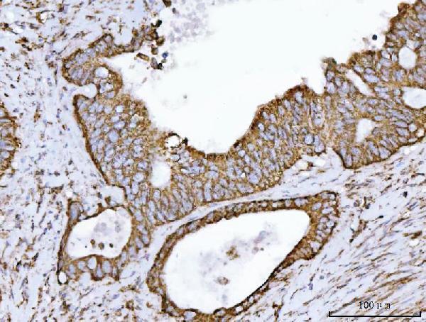 a04508 1 echs1 primary antibodies ihc testing 4