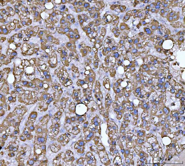 a04508 1 echs1 primary antibodies ihc testing 6