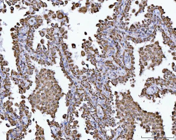a04508 1 echs1 primary antibodies ihc testing 7