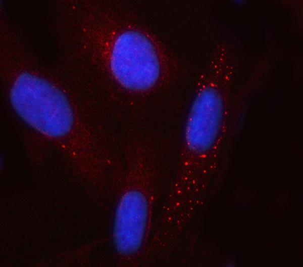  IF analysis of GCM1 using anti-GCM1 antibody (A04509-1)