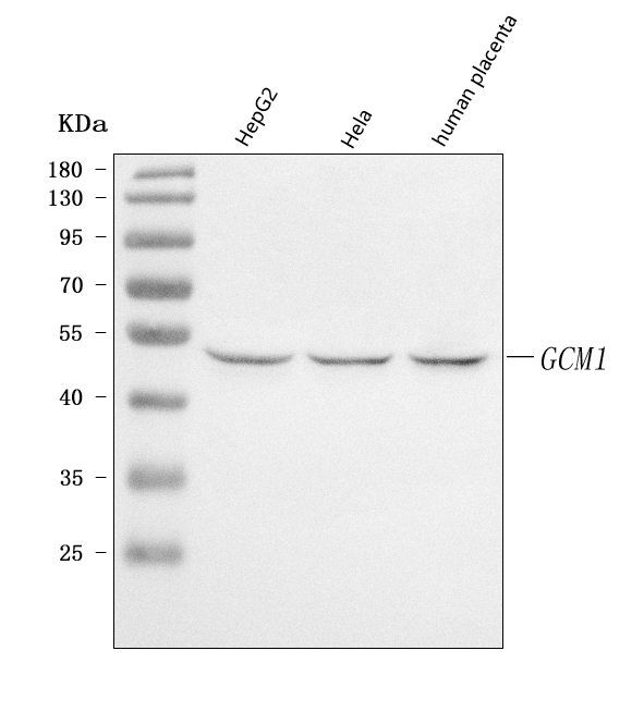  Western blot analysis of GCM1 using anti-GCM1 antibody (A04509-1)