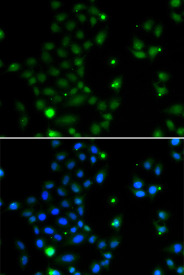 Immunofluorescence analysis of MCF-7 cells using GCM1 antibody 
