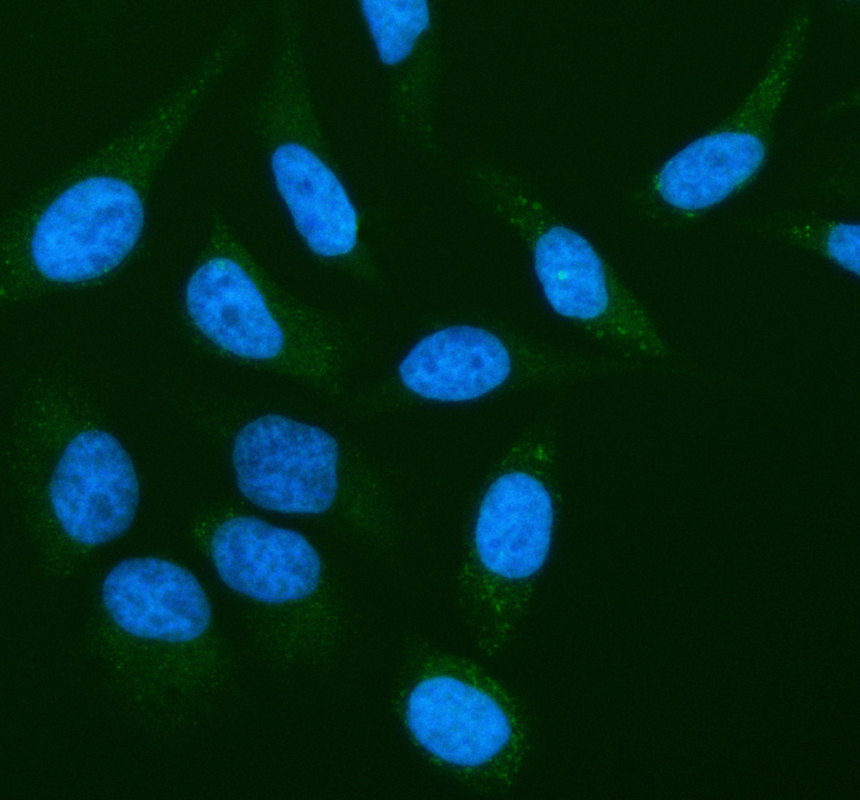 a04512 2 capg primary antibodies if testing 1
