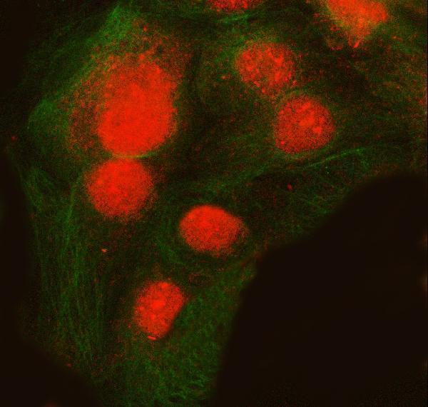 a04514 2 snrnp200 primary antibodies if testing 19
