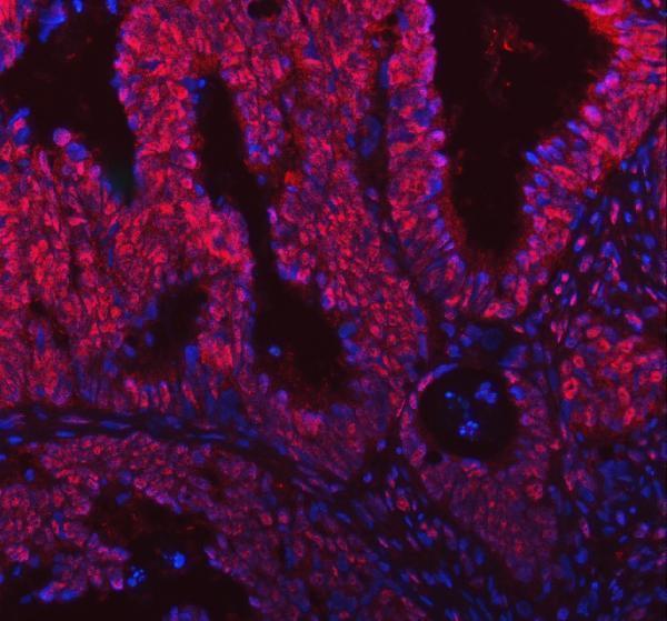 a04514 2 snrnp200 primary antibodies if testing 20