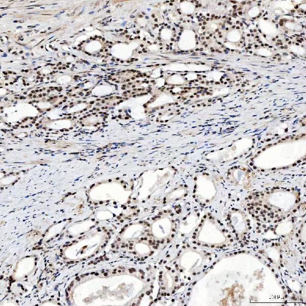 a04514 2 snrnp200 primary antibodies ihc testing 10