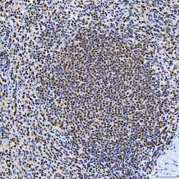 a04514 2 snrnp200 primary antibodies ihc testing 11