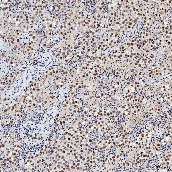 a04514 2 snrnp200 primary antibodies ihc testing 12