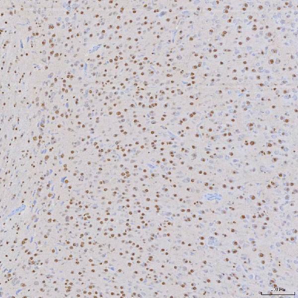 a04514 2 snrnp200 primary antibodies ihc testing 13