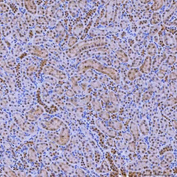 a04514 2 snrnp200 primary antibodies ihc testing 14