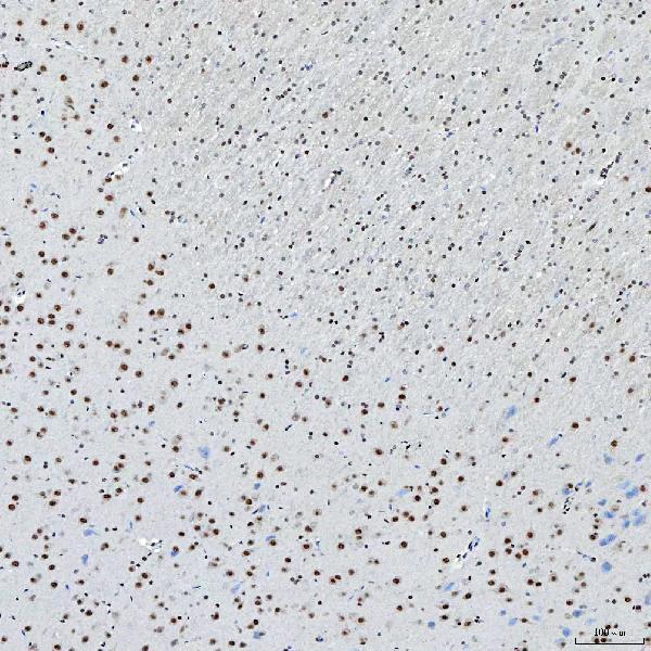 a04514 2 snrnp200 primary antibodies ihc testing 15
